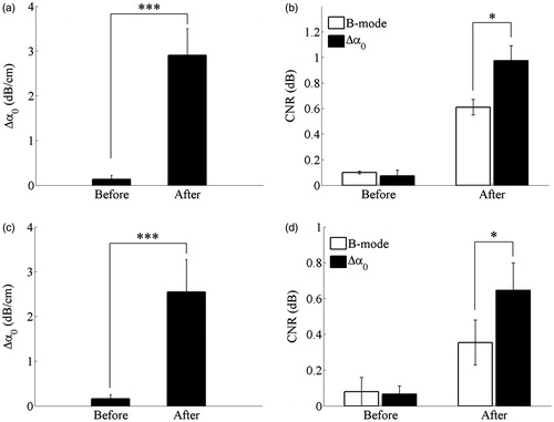 Figure 6. Statistical results for (a, c) ultrasonic Δα0 values calculated within the thermal lesion region of interest (ROI1), before and after MWA exposure, and (b, d) CNR calculated between the MWA-induced thermal lesion (ROI1) and surrounding normal tissue (ROI2) in the porcine (a, b) liver and (c, d) kidney. Values were calculated from the ROIs shown in Figures 3 and 5, respectively, and are presented as group means. Error bars represent ±1 standard deviation. *p < 0.05; ***p < 0.001.