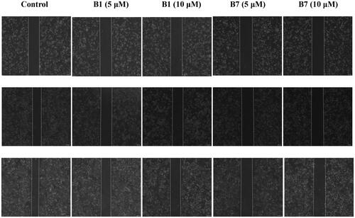 Figure 5. In vitro wound healing assays were performed on A549 cells with different concentrations of B1 and B7.