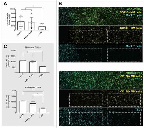 Figure 7. TEGs migrate and target primary myeloma in a 3D BM niche model. (A) Quantification of primary CD138+ myeloma (MM) cells present in the 3D BM niche model after 16 days (n = 6). Average presence of CD138+ myeloma cells in the controls, or 48 hours after mock T cell or TEG addition. # = P < 0.05. (B) Confocal images (merged z-stack, maximum intensity) showing one representative donor after 16 days of culture (14 days pre-culture, 48 hours of culture with added T cells). CD138+ myeloma cells (DiI, yellow) co-cultured with both MSCs and EPCs (DiO, green) 48 hours after mock T cell addition (DiD, cyan). No differences are observed in number of CD138+ myeloma cells comparing the periphery (left dashed region) and center (right dashed region) of the construct, the mock T-cells did not migrate into the co-culture (white dashed squares). CD138+ myeloma cells (DiI, yellow) co-cultured with both MSCs and EPCs (DiO, green), 48 hours after TEG addition (DiD, cyan). Less CD138+ myeloma cells are present in the periphery, compared to the center of the culture. TEGs migrated from the left border into the BM niche model (white dashed squares). (C) Quantification of primary CD138+ myeloma (MM) cells present in the 3D BM niche model after 16 days (14 days pre-culture, 48 hours of culture with added T cells), comparing the previously used allogeneic T cell treatment with an autologous T cell treatment (n = 2). No differences were observed when comparing MM viability after allogeneic or autologous TEG treatment, nor between control and Mock T cells. # = P < 0.05, ## = P < 0.01.