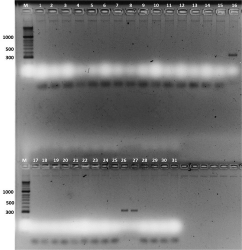 Fig. 3 Detection of FOV from diseased parts of plant (root, stem, leaves, seeds): M-HyperLadder II (Bioline Inc., USA); 1 – non-infected plant root tissue; 2 – non-infected plant leaf tissue; 3 – FOV race 3, a monosporic isolate; 4 – infected plant with FOV race 1; 5 – infected plant with FOV race 4 FOV; 6 – infected plant with root rot (F. solani) isolate; 7 – plant root tissues infected with FOV race 3 (isolate 316); 8–plant seed tissue infected with FOV race 3 (isolate 316); 9–plant root tissue infected with FOV race 3 (isolate 347); and 10 – non-infected seed tissue. Note: sample no. 8 revealed very week, but noticeable amplification product. Additional information for the rest of the samples (11 – 31) can be found in Table 1.