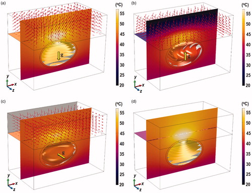 Figure 4. Contours of the temperature distribution at x = 0 and z = 0 planes 10 min after laser exposure. (a) Case I, (b) Case II, (c) Case III, and (d) Case IV. The temperature distribution inside the bladder is visualized using isothermal surfaces in order to show the flow-induced variation. Results were obtained for ϕ = 0.001% and Plaser = 0.2 W. The yellow arrows show the direction of gravity and the red arrows show the flow field. Figures indicate significant changes in the isotherms inside the bladder due to natural convection under different bladder orientation.