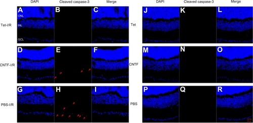 Figure 9 Tet and CNTF inhibited the expression of cleaved caspase-3 in the retinas 1 day after I/R insult.