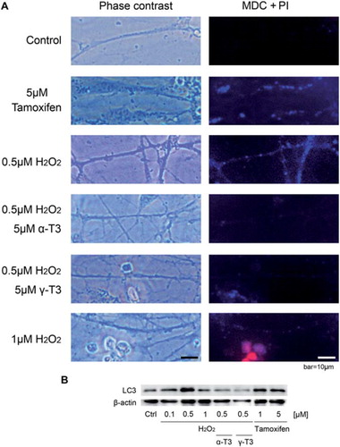 Figure 5. Treatment with hydrogen peroxide induced autophagy in CGCs, and its prevention by tocotrienols. Immunocytochemical analysis of CGCs using the double staining system of MDI and PI. CGCs were treated with 0.5 μM of hydrogen peroxide in the presence or absence of α-tocotrienol (5 μM) or γ-tocotrienol (5 μM). After 24 h, the cells were treated with PI solution (1:1000) for 2 min at R/T. After PI staining, the cells were treated with MDC solution (1:1000) for 10 min at 37°C. Treatment with 5 μM Tamoxifen was used as a control. Photomicrographs of the cells were taken and analyzed on a personal computer. At least, three wells were used per experiment. The scale bar is 10 μm (A). CGCs after treatment with hydrogen peroxide in the presence or absence of α-tocotrienol (5 μM) or γ-tocotrienol (5 μM) were lysed and used for Western blotting analysis. The same membranes were reprobed and used for the detection of β-actin. Two different concentrations of Tamoxifen were used as a control of autophagy. After 24 h, the cells were lysed and used for Western blotting (B). Each data represents the mean of three independent experiments.