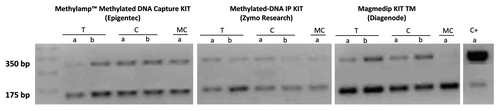 Figure 2. Agarose gel intensity after Nco I digestion for the two different aliquots of the same samples processed by three different MeDIP kits: Methylamp™ Methylated DNA Capture KIT (Epigentek), Methylated-DNA IP KIT (Zymo Research) and MagMeDIP KIT TM (Diagenode). T: Fresh Tissue DNA. C: Cell line DNA. MC: Methylated DNA Control. C+: Methylated/Non-methylated Control DNA