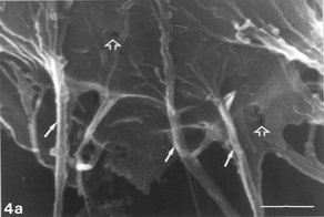 FIG. 4 AAP, 48 h. Distended cell entering initial phase of rounding up. Note tiny gaps still extant (hollow arrows). Also, note extensive system of filopodia emerging from cell body and circumference (arrows), and multiple rounded cells (double arrows) along with vast denuded areas on glass substrate after massive debridement (4c). Bar: (a) 1.0 µm; (b) 100 µm; (c) 1.0 mm.