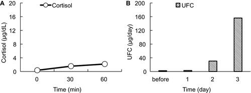 Figure 5 ACTH stimulation tests. (A) Conventional dose rapid ACTH stimulation test using 250 µg synacthen. Circles and a solid line represent the serum cortisol level. (B) Prolonged ACTH stimulation test using 0.5 mg tetracosactide twice daily. Vertical gray columns represent UFC. Horizontal axes indicate time courses. Vertical axes indicate values.Abbreviations: ACTH, adrenocorticotropic hormone; UFC, urinary free cortisol.