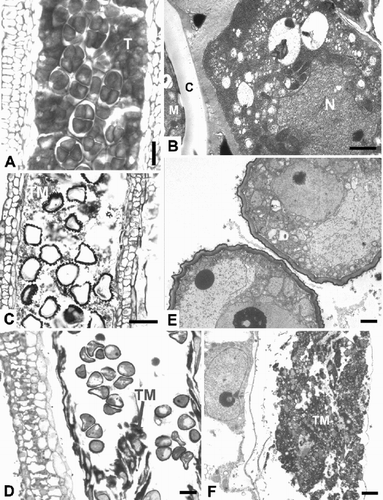 Fig. 5. Anthers of Bromeliaceae. A–C. Aechmea aquilega: (A) Anther locule with tetragonal tetrads surrounded by tapetal cells (LM); (B) Tapetal cell with a large nucleus adjacent to a tetrad (TEM); (C) Anther locule with sterile pollen (empty exines) surrounded by tapetal debris (LM). D – F. Aechmea abbreviata: (D) Anther locule with free microspores recently released from the callose wall and tapetal material inside the locule (LM); (E) Detail of microspores (TEM); (F) Remains of a tapetal cell at the edge of the anther locule (TEM). C=callose, M=microspore of tetrad, N=nucleus, T=tapetum, TM=tapetal material. Bars – 30 μm (A, C, D); 2 μm (B, E, F).