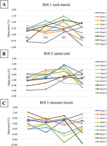 Figure 3. The temperature changes expressed as mean errors for different scan settings (numbered in accordance with Table 4) over time; for A: ROI 1: neck muscle, B: ROI 2: spinal cord and C: ROI 3: masseter muscle.