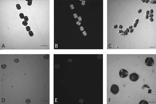 Figure 4. Pollen content of monofloral honeys of Mimosa sp. (A–C) and Prosopis sp. (D–F). Microphotgraph of honey samples (A, B, D, E) are compared against reference standards of Mimosa sp. (C) or Prosopis sp. (F). A, C, D, F are 2D projections of a Z-stack taken with a 40× objective. B, E are auto-fluorescence views from de equatorial section of A and D, respectively. Scale bars – 20 μm.