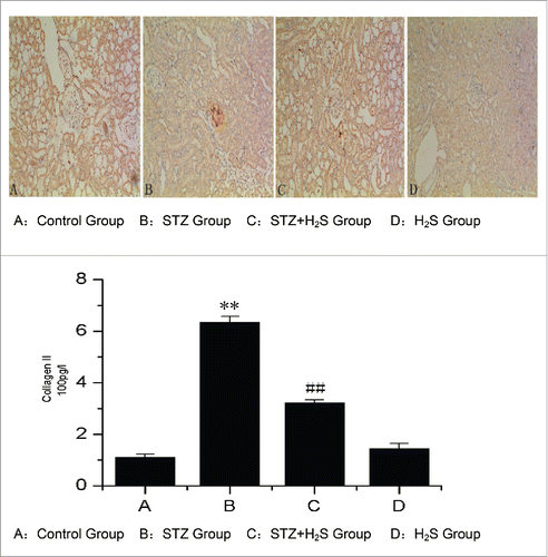 Figure 2. Expression of Collagen II in diabetic rats in each group. (A: Control Group, B: STZ Group, C: STZ+H2S Group, D: H2S Group).