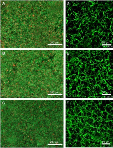 Figure 4 Appearance of the cell layers on NCD films.Notes: LIVE/DEAD staining (A–C) and immunofluorescence staining of type I collagen (D–F) in Saos-2 cells after 2-week culture in the medium with added AA on H-terminated NCD films (A and D); on O-terminated NCD films (B and E); and on glass (C and F). Seeding density was 25×103 cells/cm2; differentiation occurred after confluence. Fluorescence microscopy (Olympus IX 51) (A–C). Confocal microscopy (Leica TCS SPE), maximum projection (D–F).Abbreviations: NCD, nanocrystalline diamond; AA, ascorbic acid.