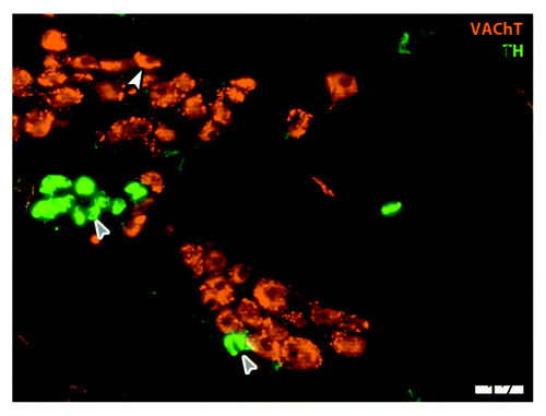 Figure 2. Parasympathetic cardiac ganglion. Immunohistochemical staining in an adult rat cardiac ganglion for cholinergic marker vesicular acetylcholine transporter (VAChT; red) and catecholaminergic marker tyrosine hydroxylase (TH; green). Neurons stain in the soma for VAChT (white arrowhead) and also receive input from cholinergic pre-ganglionic terminals (small varicosities around cell bodies). Small intensely fluorescent (SIF; gray arrows) cells are catecholaminergic and believed to function as inter-neurons; here SIF cells make contact with each other and with a cholinergic neuron (Moses M., Macek A. Hasan W.; unpublished data). Scale bar is 50 υm.