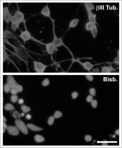 Figure 5. Enrichment of RGCs through a Percoll gradient. βIII tubulin staining (βIII Tub.) performed in a culture enriched in RGCs. Nuclei were stained with bisbenzimide (Bisb.). Bar: 20 μm.