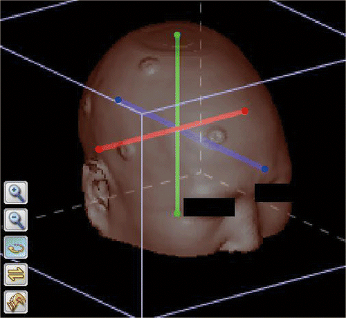 Figure 2. The position of the TRE sampling points. The red, green and blue lines are the X′, Y′ and Z′ sampling line segments, respectively. They intersect at a point at the center of the head, and are parallel to the X, Y and Z coordinate axes of the volume data.