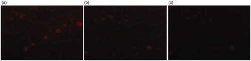 Figure 7. Laser scanning confocal micrograph of control in different times. (a) 2 h in vitro treatment with control; (b) 6 h in vitro treatment with control; (c) 12 h in vitro treatment with control.