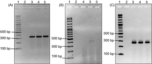 Figure 4. The effect of C. nutans root extracts on the expression of ACTB (a), BCL2 (b) and BAX (c) in MCF-7 breast cancer cell line by RT-PCR. Lane 1: 100 bp DNA marker, lane 2: negative control, lane 3: without treatment, lane 4: methanol root extract and lane 5: acetyl acetate root extract.
