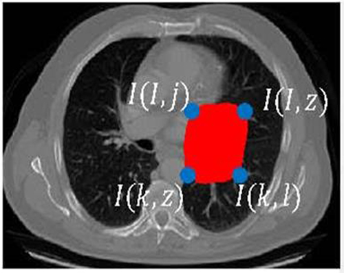 Figure 2 Region identification (in red color) based on generative embedding using proposed method where I (i,j) denotes specific pixel.