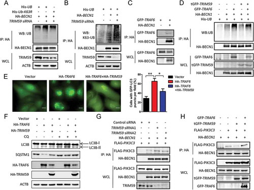 Figure 4. TRIM59 inhibits TRAF6-mediated ubiquitination of BECN1. (a) H1299 cells were co-transfected with plasmids encoding His-UB or His-UB-K63R, HA-BECN1 and either TRIM59 siRNA or control siRNA. Proteins were immunoprecipitated with HA antibody, and the ubiquitination was detected using an antibody specifically targeting ubiquitin. Exogenous BECN1 was detected using anti-HA antibody. Endogenous TRIM59 was detected using anti-TRIM59 antibody. (b) H1299 cells were co-transfected with His-UB, HA-BECN1 and either TRIM59 siRNA or control siRNA. Proteins were immunoprecipitated with HA antibody and the K63 linked ubiquitination was detected using an antibody specifically targeting ubiquitin that was K63 linked. (c) H1299 cells were co-transfected with plasmids encoding GFP-TRAF6 and either HA-BECN1 or empty vector. The cell lysates were immunoprecipitated with HA antibody and blotted with anti-HA or anti-GFP antibodies. (d) 293T cells were co-transfected with the indicated plasmids. Proteins were immunoprecipitated with HA antibody, and the ubiquitination was detected using an antibody specifically targeting ubiquitin. Exogenous BECN1, TRIM59 and TRAF6 were detected using anti-HA, anti-tGFP and anti-GFP antibodies. (e) H1299 cells stably expressing GFP-LC3B were co-transfected with pCMV-HA-TRAF6 (HA-TRAF6) and either pCMV-HA-TRIM59 (HA-TRIM59) or empty vector. After 48 h, the cells were analyzed by fluorescence microscopy (Olympus IX83). Scale bar: 10 μm (left panel). The cell numbers with GFP-LC3B puncta were counted under 200× magnification. *P ≤ 0.05, **P ≤ 0.01 (right panel). (f) H1299 cells stably expressing GFP-LC3B were co-transfected with a plasmid encoding HA-TRAF6 and either HA-TRIM59 or empty vector. After 46 h, the cells were treated with or without 20 μM chloroquine (CQ) for 2 h. The autophagy-related proteins were analyzed by western blot. (g) H1299 cells were co-transfected with the indicated exogenous genes and siRNAs. After 48 h, the cells were lysed and immunoprecipitated with HA antibody. FLAG-PIK3C3 and HA-BECN1 were detected using anti-FLAG and anti-HA antibodies. TRIM59 was detected using anti-TRIM59 antibody. (h) 293T cells were co-transfected with HA-BECN1 and the indicated exogenous genes. Two days later, the cells were lysed and immunoprecipitated with HA antibody. FLAG-PIK3C3 and HA-BECN1 were detected using anti-FLAG and anti-HA antibodies. GFP-TRAF6 and tGFP-TRIM59 were detected with anti-GFP and anti-tGFP antibodies.