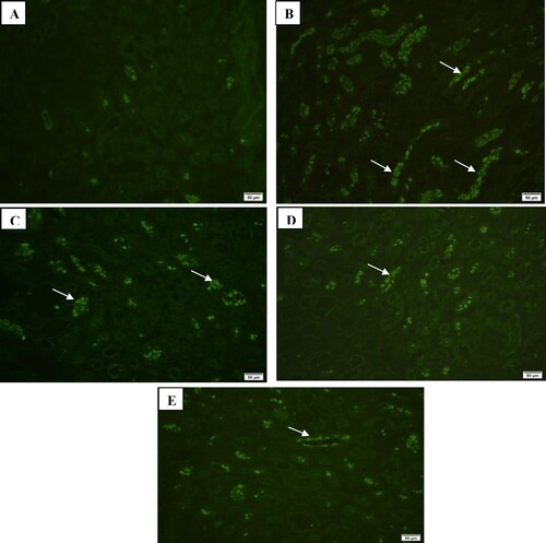 Figure 8. Immunofluorescence investigation of collagen IV in kidney tissues showing: (A) mild expression in control group (200×), (B) marked expression in CKD group (200×), (C) moderate expression in SPL group (200×), (D) mild expression in ZnO-NPs group (200×), and (E) mild expression in SPL + ZnO-NPs group (200×).
