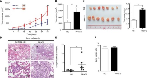 Figure 4 PRAF2 promotes tumor growth and metastasis in vivo.Notes: (A–C) Bel-7402 cells (1×107) stably expressing PRAF2 were injected into the right flank of nude mice. Tumor volume was measured every 4 days (A). After 30 days, the tumors were measured (B) and weighed (C right); the representative images of the xenograft are shown (C left). (D) Cells expressing PRAF2 were injected into the mice through the tail vein. The lungs were fixed in 4% paraformaldehyde and sectioned for H&E staining. (E) The number of metastases was counted. Values are presented as mean ± SEM. (F) Ratio of lung weight vs body weight. *P<0.05, **P<0.01.Abbreviations: H&E, Hematoxylin Eosin; NC, Negative control; PRAF2, prenylated Rab acceptor 1 domain family member 2.