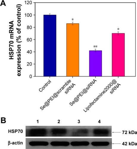 Figure 7 Suppression of HSP70 mRNA and protein expression in HepG2 cells among Se@PEI@scramble siRNA, Se@PEI@siRNA, and Lipofectamine 2000@siRNA.Notes: (A) Suppression of HSP70 mRNA levels was quantified by Q-PCR. (B) The expression of HSP70 was evaluated by Western blot. Bars with different characters are statistically different at P<0.05 (*) or P<0.01 (**) level.Abbreviations: HSP, heat shock protein; mRNA, messenger RNA; Q-PCR, quantitative polymerase chain reaction; Se@PEI@siRNA, small interfering RNAs with polyethylenimine-modified selenium nanoparticles.
