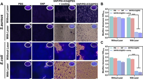 Figure 5 (A) Biofilm inversion fluorescence imaging and biofilm imaging of the different groups after treatment (PBS, SNP, SNP/PEI-ICG@PEG + cooling, SNP/PEI-ICG@PEG, PBS + Laser, SNP+Laser, SNP/PEI-ICG@PEG + Laser + cooling, SNP/PEI-ICG@PEG + Laser; The concentration of each drug was 450 μg/mL; bar=50 μm). (B) The biofilm OD570 values of S. aureus dissolved by ethanol. (C) The biofilm OD570 values of E. coli dissolved by ethanol. The error bars represent the standard deviations obtained from three independent measurements (mean ± SD, n=3; ****p < 0.0001).