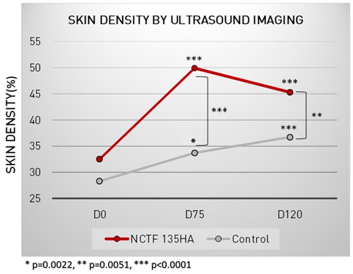 Figure 4. Skin density assessed on the crow’s feet and the cheeks using high-frequency ultrasound imaging.