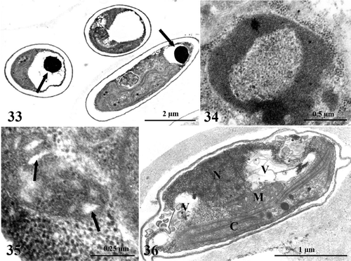 Figs. 33–36. TEM images of Koliella antarctica cells maintained in complete darkness for 60 days. Fig. 33. Overall aspect of cells showing general alteration; large dark globules are deposited inside vacuoles (arrows). Fig. 34. Nucleus lacks the nucleolus; chromatin is condensed in a ring close to the envelope. Fig. 35. Mitochondrion with swollen cristae (arrows). Fig. 36. Overall appearance of degenerating cell. C, chloroplast; M, mitochondrion; N, nucleus; V, vacuole.