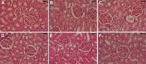 Figure 11 Histology of the kidney.Notes: (A) Control group, showing normal glomeruli with normal baseline and tubules. (B) SeNP-treated group, showing normal glomeruli with normal baseline and tubules. (C) STZ group, showing shrunken or completely lost glomeruli, intratubular blood congestion, loss of glomerular lobulation tubular cytoplasmic vacuolation, and some pyknotic nucleus. (D) STZ-SeNP-treated group, SeNPs improved the glomeruli with no infiltration of lymphocytes. (E) STZ-Ins-treated group, insulin treatment showing normal glomeruli with no infiltration of lymphocytes. (F) STZ-SeNPs-Ins-treated group, SeNPs, and insulin showing normal glomeruli with no infiltration of lymphocytes and with improved structure of tubules. Sections stained with hematoxylin and eosin. Scale bar =50 μm.Abbreviations: Ins, insulin; SeNPs, selenium nanoparticles; STZ, streptozotocin.