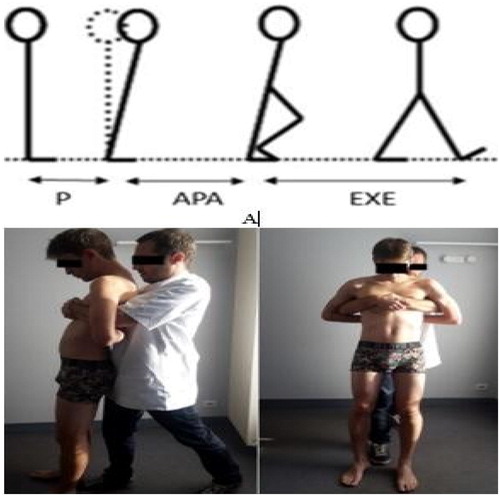 Figure 1. (A). Stick representation of gait initiation. P: standing posture; APA: anticipatory postural adjustments; EXE: step-execution; (B) HVLA Manipulation.