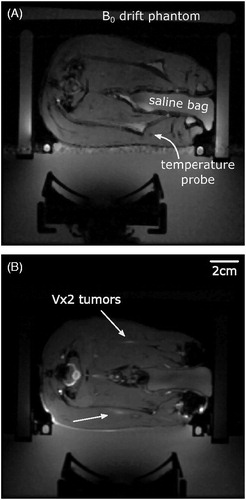 Figure 2. Anatomical MRI images of the experimental setup used to verify acoustic coupling and select the target anatomy. (A) T2*-weighted image of healthy rabbit thigh muscle with heavy mineral oil phantoms placed around the animal and a degassed saline bag placed between the animals legs. Flow artefacts from the water in the heating coil are visible along the phase-encoding direction and therefore the warm water pump was turned off for the duration of the hyperthermia treatments. (B) Gadolinium-enhanced fat-saturated T2*-weighted image of rabbit thigh muscle with bilateral Vx2 tumors (white arrows).