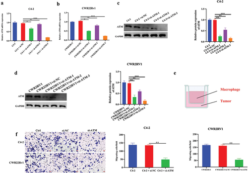 Figure 3. ATM promotes the ability of macrophage recruitment in CRPC cells in vitro. a, b. q-PCR analysis of ATM knockdown efficiency in CRPC cell lines. GAPDH was used for normalization. c, d. Western blotting analysis of a knockdown of ATM in CRPC cell lines. GAPDH was used for normalization. e. co-cultured CRPC cell lines with M2 macrophages using transwell chambers. f. transwell assays for CRPC cell lines after co-culturing with or without M2 macrophages. Scale bar = 50 μm. Data are presented as the mean ± SD; n = 3; **P < .01; ***P < .001. Data were analyzed by using one-way ANOVA with Tukey’s multiple comparisons.