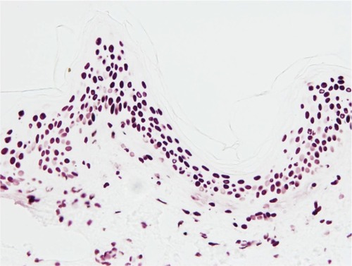 Figure 2 Immunostaining of thymine dimers in the epidermis (sample batch, day 6).