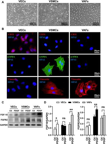 Figure 2 PDGF differentially regulates expression of FGF10 and FGFR2 in VECs, VSMCs and VAFs. VECs, VSMCs and VAFs were isolated from rat aorta and cultured. (A) Morphological features of VECs, VSMCs and VAFs in primary cultures. Bar=200μm. (B) Immunofluorescence staining of CD31, α-SMA and Vimentin in three types of cells. Nuclei were stained with DAPI. Bar=20μm. (C and D) Representative WB images (C) and summaries (D) of FGF10 and FGFR2 protein expressions in three types of cells with or with put treatment of PDGF (20ng/mL). n=3. *p<0.05 and **p<0.01.