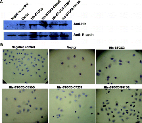 Figure 1. Expression analysis of wild-type and mutant STGC3 genes in CNE2 cells. Western blotting results (A) and immunocytochemistry staining results (B) of the six groups. Cells with yellow or brown staining showed positive staining.