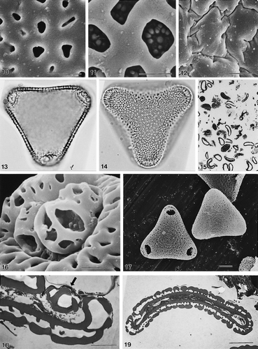 10–19. Sclerosperma spp. 10–12. Close ups to show range of exine types (SEM): (10) S. mannii Gillett, 279, coarsely perforate; (11) S. mannii Tuley s.n., reticulate; (12) S. gilletii Profizi, 84102, rugulate. 13–15. S. mannii Gillett, 279, (LM): (13) pollen in polar view, in mid focus; (14) ibid. in high focus; (15) semi-thin section of unacetolysed pollen grains, stained with toluene blue; note high proportion of “empty” pollen exines. (16) S. mannii Gillett, 279, close up of pore, unacetolysed pollen grain, with operculum in place (SEM). (17) S. mannii Gillett, 279, polar views of two acetolysed pollen grains (SEM): distal face (left), proximal face (right). (18) S. mannii Hall & Enti, GC36150: ultrathin TEM section to show pore with operculum in situ (arrow). (19) S. mannii Gillett, 279, ultrathin TEM section of unacetolysed pollen; note poor preservation of cellular material. LM Figs.: ×150 (in 15); ×1000 (in 13, 14). In SEM & TEM Figs. scale bars: 2.5 μm (in 10–12, 16 & 18); 10 μm (in 17, 19).