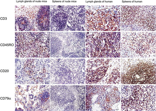 FIGURE 5. Immunohistochemical staining for T and B lymphocyte markers of the newly formed lymphoid nodules and spleens of the nude mouse compared with human markers.In the newly formed node of the nude mice, lymphocyte-like cells were partly positive for the T cell markers CD3 and CD45RO between or inside the follicles, and some of the cells were weakly positive for B cell markers CD20 and CD79α that were mainly located inside the follicles. In human lymph node and spleen tissues, CD20- and CD79α-positive cells were mainly found inside the follicles, while CD3- and CD45RO-positive lymphocytes were mainly distributed throughout the interfollicular areas. No immunoreactivity was detected in spleens of the experimental nude mice. Bar = 50 µm.