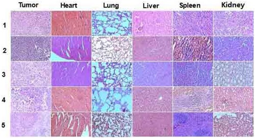 Figure 8 H&E-stained images of tumor, heart, lung, liver, spleen and kidney collected from different groups ((1) control (normal saline), (2) 808 nm NIR, (3) Ce6+808 nm NIR, (4) UCNPs@mSiO2-Ce6+808 nm NIR and (5) UCNPs@mSiO2-Ce6-GPC3+808 nm NIR) on the 14th day.