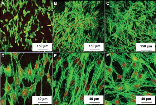 Figure 7 Fluorescence images of the MC3T3-E1 cells cultured for 5 days on titanium control, NT-Ti, and AgNP-NT-Ti.Notes: (A and D) Titanium control. (B and E) NT-Ti. (C and F) AgNP-NT-Ti.Abbreviations: NT-Ti, titanium foil sample with hydrogen titanate nanotube layer; AgNP, silver nanoparticle; AgNP-NT-Ti; AgNP-filled nanotube layer on the titanium foil surface.