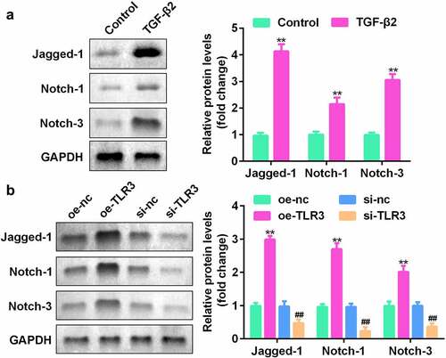 Figure 5. TLR3 directly acts on the Jagged-1/Notch signaling pathway. (a) Western blotting was used to detect the expression levels of the Jagged-1/Notch pathway proteins in LECs treated with or without TGF-β2 (5 ng/mL) for 48 h. (b) After transfection with si-TLR3 and overexpressed TLR3, LECs were treated with TGF-β2 (5 ng/mL). The expression levels of the Jagged-1/Notch pathway proteins were detected by western blotting. **P< 0.01, ***P< 0.001 vs. Control or oe-NC group. ##P< 0.01, ###P< 0.001 vs. si-nc group.