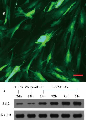 Figure 1. Genetic transduction of adipose-derived stem cells. (a) Representative photomicrograph of adipose-derived stem cells transducted with adenovirus encoding GFP gene. (b) Representative Western blots showing overexpression of Bcl-2 protein in Bcl-2 modified adipose-derived stem cells, which remained at a high level for 21 d after transduction. Housekeeping protein β-actin served as loading control. Scale bars = 100 μm.