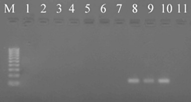Figure 1 PCR amplification using Sclerotinia sclerotiorum specific primers SIG2598F and SIG2767R to amplify 170-bp of DNA. M: 100-bp DNA ladder; Lane 1, Alternaria alternata; Lane 2, Cladosporium cladosporioides; Lane 3, Fusarium oxysporum; Lane 4, Microsphaeropsis tanaceti; Lane 5, Stagonosporopsis ligulicola var. inoxydabilis; Lane 6, Boeremia exigua var. exigua; Lane 7, Botrytis cinerea; Lane 8, Sclerotinia minor; Lane 9, Sclerotinia trifoliorum; Lane 10, Sclerotinia sclerotiorum; Lane 11, no DNA control.