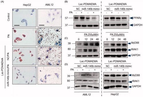 Figure 4. Anti-steatosis activity of Lac-PDMAEMA/miR-146b mimic in HepG2 and AML12 cells in vitro: Cells were pre-treated with 100 nM Lac-PDMAEMA/NC or Lac-PDMAEMA/miR-146b mimic for 4 h, and then treated with PA (250 μM) for 48 h. (A) Oil-red O was used to determine the lipid accumulation. Scale bar, 25 µm. (B) Western blot was used to determine the protein levels of PPARγ, and the result was normalized with GAPDH. (C) Confluent HepG2 and AML12 cells were incubated with 250 μ5 PA for indicated period. MyD88 and IRAK1 protein expression were examined by western blotting. The results, normalized with GAPDH. (D) Cells were pre-treated with 100 nM Lac-PDMAEMA/NC or Lac-PDMAEMA/miR-146b for 4 h, and then treated with PA (250 μM) for 48 h. MyD88 and IRAK1 protein expression were examined by western blotting. The results were normalized with GAPDH.