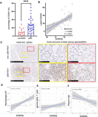 Figure 8 Correlation between the expression of SAMD9L and immune cells. (A) percentage of CD45+immune cells in MSGs of pSS significantly higher than that of non-pSS. (B) a strong positive correlation was found between SAMD9L and labial CD45 percentage (C) CD45 staining of MSGs from pSS and non-pSS; (D–F) correlation between the expression of SAMD9L and infiltration fraction of immune cells. ***P<0.001.