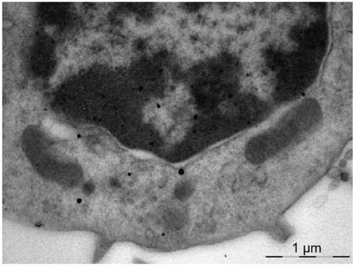 Figure 9 Gold nanoparticles uniformly distributed throughout the cytoplasm and nucleus of an alveolar macrophage.Notes: The two-contour organization of the nucleus membrane is intact throughout. There is a mitochondrion visible which is not interacting with nanoparticles but, nevertheless, is intact only partly. Transmission electron microscopy, magnification ×22,000.