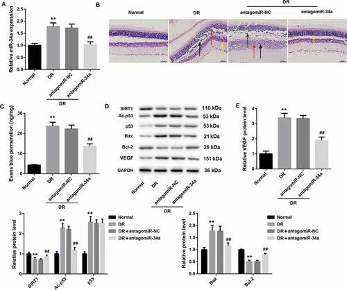 Figure 2. MiR-34a silencing inhibits the progression of DR in rats by regulating apoptosis and VEGF expression