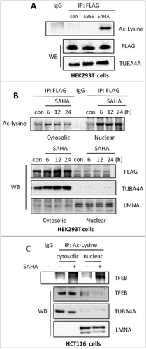 Figure 4. SAHA treatment increases TFEB acetylation level. (A) HEK293T cells were transiently transfected with the pCMV-3 × Flag-TFEB and then treated with 2 μM SAHA for 12 h or starved in EBSS for 2 h. Cells were lysed and subjected to FLAG immunoprecipitation followed by immunoblotting for Ac-lysine. (B) HEK293T cells were transfected with pCMV-3 × Flag-TFEB as in (A) and then treated with 2 µM SAHA as indicated. Cytosolic and nuclear fractions were then prepared and subjected to FLAG immunoprecipitation. Imunoblotting of acetylated-lysine was performed. TUBA4A and LMNA were used as quality control for the cytosolic and nuclear fractions, respectively. (C) HCT116 cells were treated with SAHA (1 µM) for 12 h and then the cytosolic and nuclear fractions were prepared and subjected to Ac-lysine immunoprecipitation followed by immunoblotting for TFEB. TUBA4A and LMNA were used as quality control for the cytosolic and nuclear fractions, respectively.