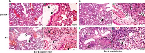 Figure 3. Histopathological analysis of lung tissues from hamsters infected with either WT or Del-mut SARS-CoV-2 virus. Lung tissues were collected on days 2 (A: a, b, e, f) and 4 (B: c, d, g, h) post-infection and processed for HE staining. Images a & b (Del-mut-1, 2 dpi) are representative images showing diffuse alveolar wall thickening, perivascular oedema, and blood vessel and alveolar-capillary congestion involving about 70% of the lung section cutting area. Bronchiolar epithelial cell swelling and a mild degree of desquamation are indicated by arrows in panel b. No infiltration or exudate was observed in the alveolar space. Image c (Del-mut virus, 4 dpi) shows diffuse alveolar wall thickening and peribronchiolar infiltration. The bronchiolar epithelial layer also shows a mild degree of desquamation (arrow). Image d shows detached epithelial cells mixed with mononuclear cells and red blood cells in the lumen of bronchioles. Image e (WT virus, 2 dpi) shows diffuse alveolar wall thickening and peribronchiolar infiltration, with a mild degree of desquamation of the bronchiolar epithelial layer (arrow). Image f shows detached epithelial cells mixed with mononuclear cells, red blood cells in the lumen of bronchiole (solid arrow), alveolar space haemorrhage and mild exudate and cell infiltration. These changes involved about 70% of the lung section cutting area. Image g (WT virus, 4 dpi) shows diffuse alveolar collapse (solid circle) and proline-rich exudates (dashed circle) and a focal area of lung consolidation (arrow). Image h (WT virus, 4 dpi) shows alveolar wall destruction, alveolar space haemorrhage and mononuclear cell infiltration (arrow). Scale bar: 500um (images a, c, e, g), 50um (images b, d, f, h).