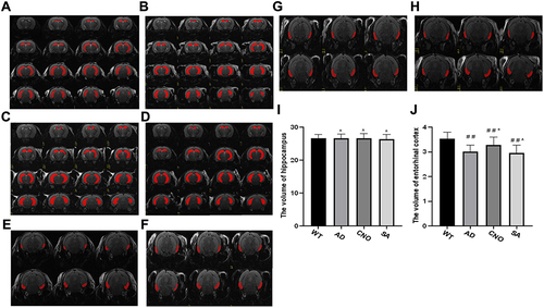 Figure 6 Effect of activation of RMTg nucleus on the volume of the hippocampus and entorhinal cortex. (A) The hippocampus of experimental mice in WT group. (B) The hippocampus of experimental mice in AD group. (C) The hippocampus of experimental mice in CNO group. (D) The hippocampus of experimental mice in SA group. (E) The entorhinal cortex of experimental mice in WT group. (F) The entorhinal cortex of experimental mice in the AD group. (G) The entorhinal cortex of experimental mice in the CNO group. (H) The entorhinal cortex of experimental mice in the SA group. (I) The volume hippocampus of each group. (J) The volume of entorhinal cortex of each group. Compared with the WT group, #P<0.05,# #P<0.01; Compared with AD group, *P<0.05, **P<0.01; Compared with AD group, ^P>0.05.