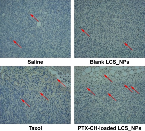 Figure 10 TUNEL assay of tumor tissues isolated from mice treated with saline, blank LCS_NPs, PTX, PTX-CH-loaded LCS_NPs, and observed by optical microscope, 100×. Red arrows represent apoptotic tumor cells.Abbreviations: LCS_NPs, lecithin–chitosan nanoparticles; PTX-CH-loaded LCS_NPs, paclitaxel–cholesterol complex-loaded lecithin–chitosan nanoparticles.